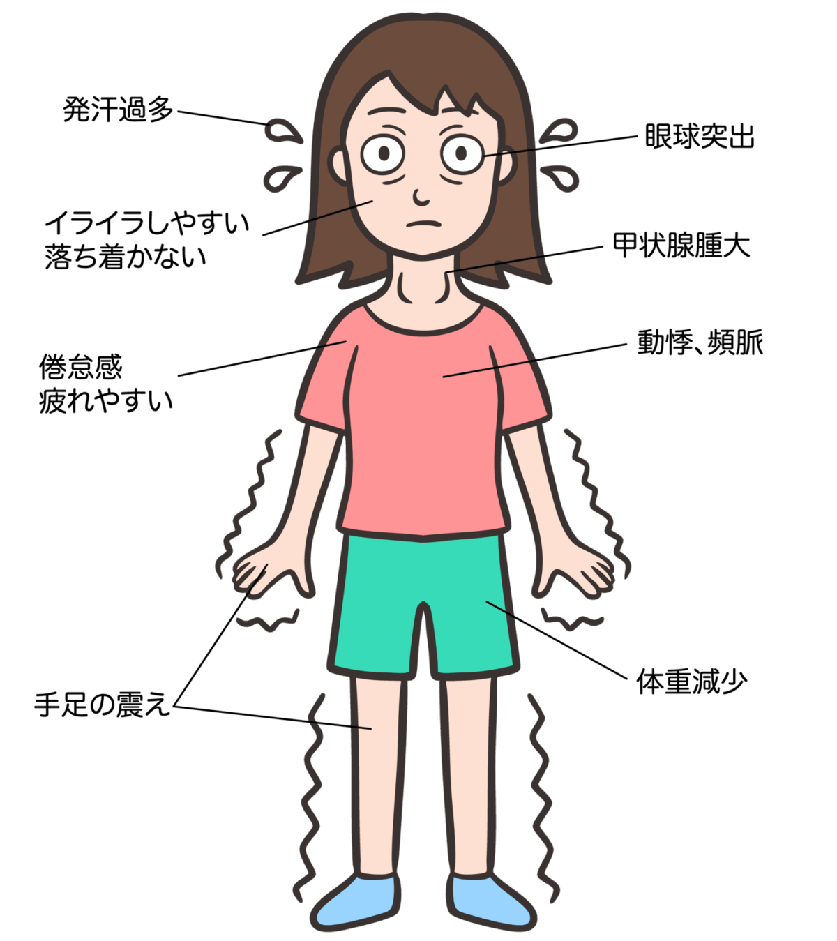 バセドウ病症状