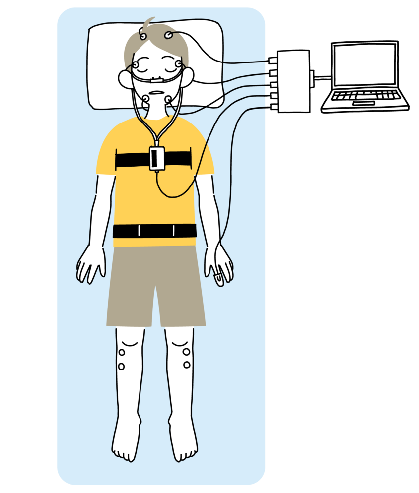 ポリソムノグラフィ